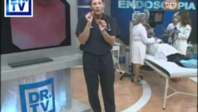 endoscopia