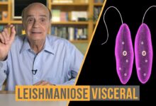 Leishmaniose: Quando as Marcas da Pele Contam uma História Silenciosa