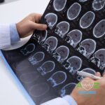 Estudo desmente mito de que câncer pode ter causas emocionais