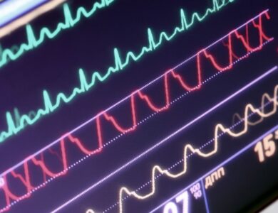 9e0aa712a3c64bf9acedcb02430c56ee