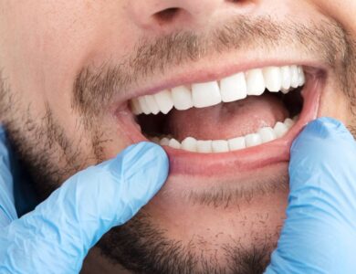 Pulpite Dentária: Guia Completo de Sintomas, Causas e Como Tratar a Inflamação no Dente 90 779a51c00a524f2d9d558e180f9c4b09