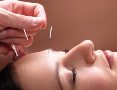 Acupuntura: As 10 Dúvidas Mais Comuns Respondidas para Você Entender o Tratamento